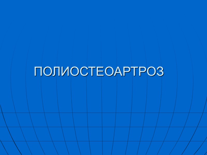 ПОЛИОСТЕОАРТРОЗ